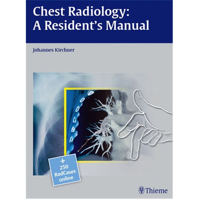 Chest Radiology: A Resident's Manual